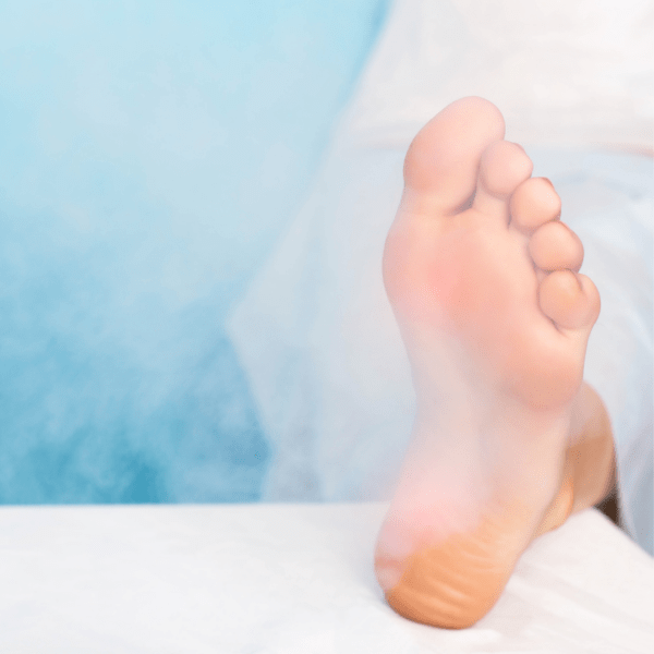 Foot Cryotherapy on Long Island