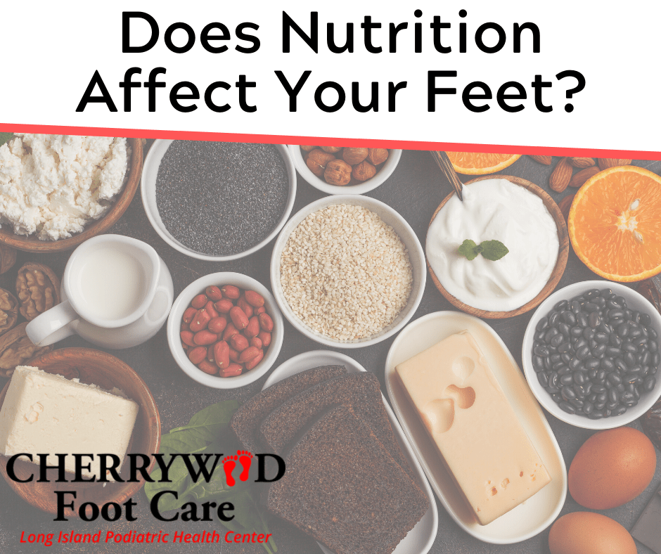 How Nutrition Can Affect Your Feet