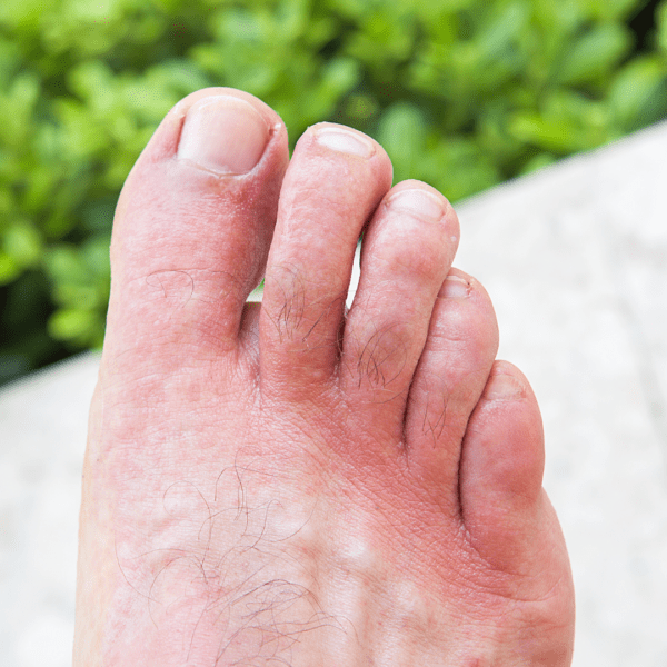 best podiatrist on Long Island