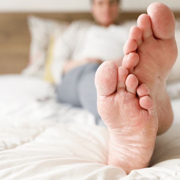 podiatrist in East Meadow