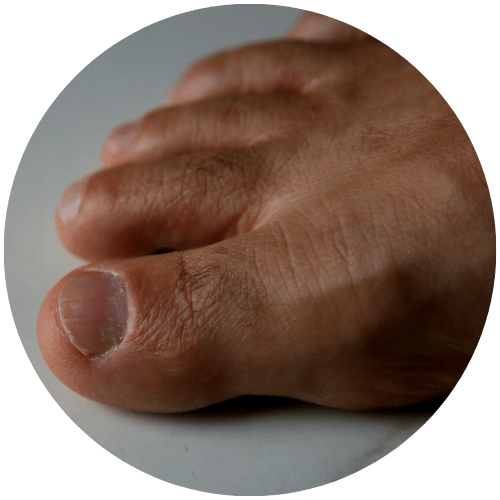 Podiatrist in Bellmore