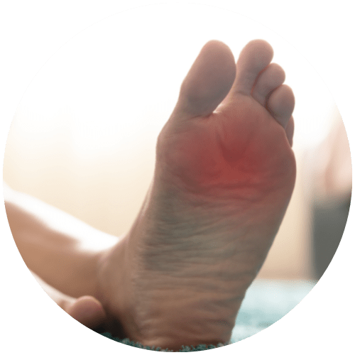 Does Wearing Socks Help Dry Feet? - Cherrywood Foot Care