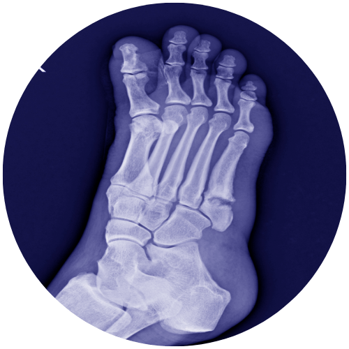 ankle surgeon in Bellmore, NY