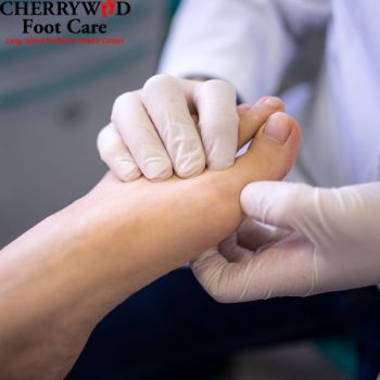 Athlete's foot treatment near East Meadow NY
