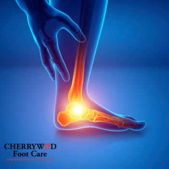 Heel pain treatment Nassau County podiatrist
