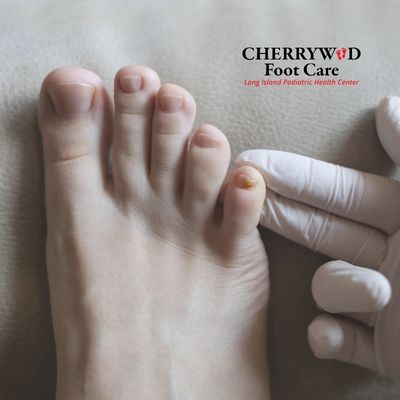 Cherrywood Foot Care Image Replacement (40)