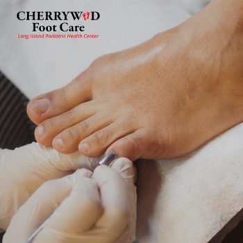 Podiatrist near Hempstead NY cherrywood