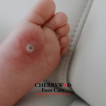 Podiatrist near Hempstead NY cherrywood (1)