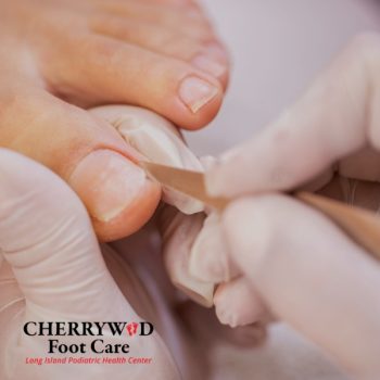 Podiatrist near Hempstead NY cherrywood (3)