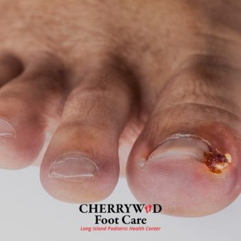 Podiatrist near Hempstead NY cherrywood (4)