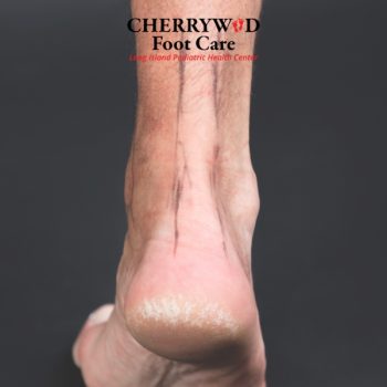 Podiatrist near Hempstead NY cherrywood (6)