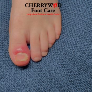 foot doctor near me 11710 cherrywood 3