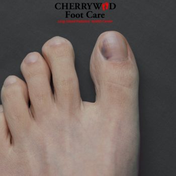 foot pain doctor nassau county cherrywood 6
