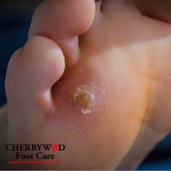 foot pain doctor in nassau county cherrywood 8