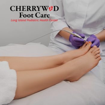 laser nail fungal treatment levittown cherrywood (2)