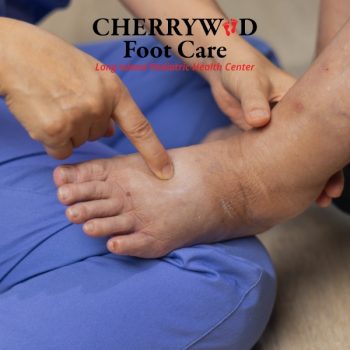 orthotics for neuropathy cherrywood