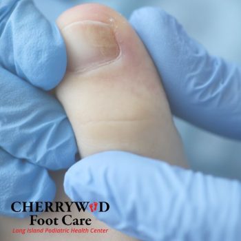 cherrywood image replacement mineola foot doctor (1)