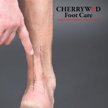 cherrywood image replacement mineola foot doctor (2)