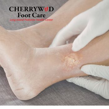 cherrywood image replacement mineola foot doctor 1