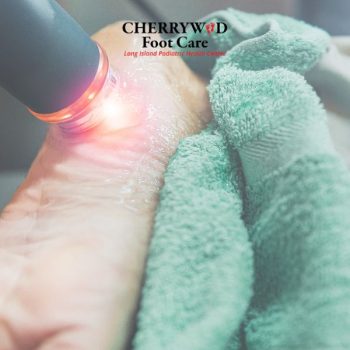 cherrywood image replacement plantar fascitiis nassau county (3)