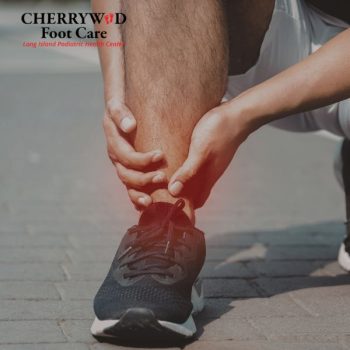 cherrywood image replacement plantar fascitiis nassau county (4)
