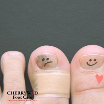 cherrywood image replacement - podiatrist near copiague NY (1)