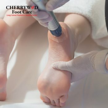 cherrywood image replacement - podiatrist near copiague NY (3)