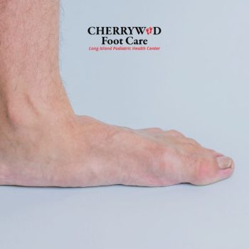 cherrywood image replacement - podiatrist near copiague NY