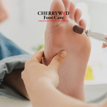 cherrywood image replacement - podiatrist near copiague NY (4)