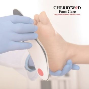 Custom orthotics for bunion treatment