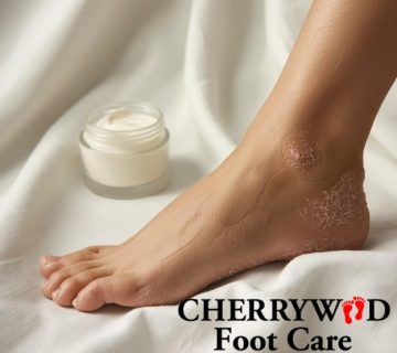 Dry winter feet