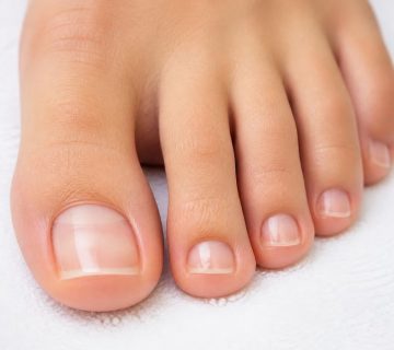 No toenail fungus